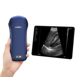 *Scanner à ultrasons sans fil 3 en 1 (Echographe portable)