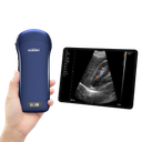 *Scanner à ultrasons sans fil 3 en 1 (Echographe portable)
